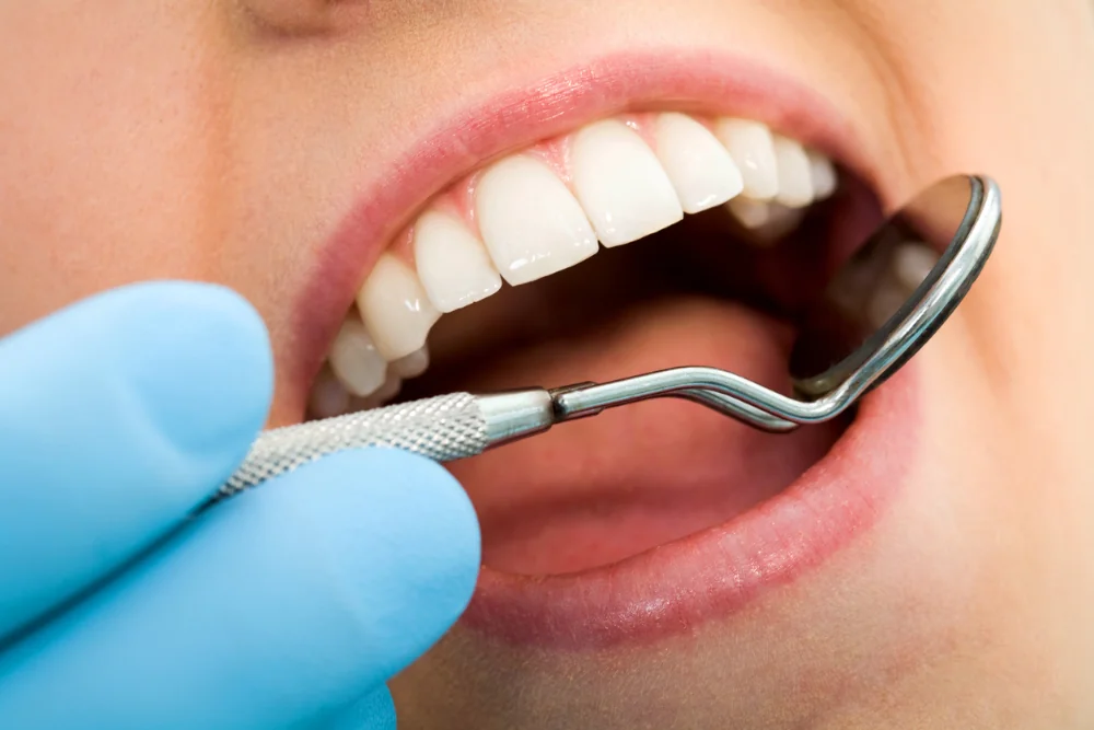 Close-up of oral exam using dental mirror at Robina Quays Dental Care